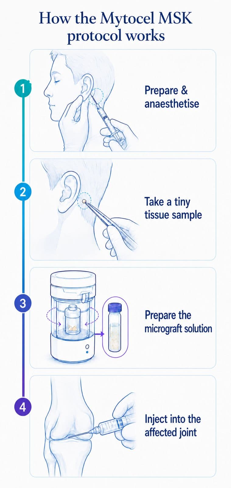 Explainer plate showing how the protocol works: prepare and anaesthetise the ear, take a tiny tissue sample, prepare the micrograft solution and inject it into the affected joint.